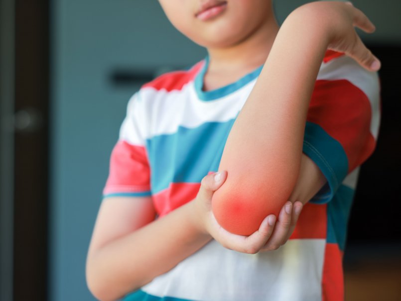 Estudio de la PUCV revela vínculo clave entre obesidad infantil, rendimiento físico y salud ósea